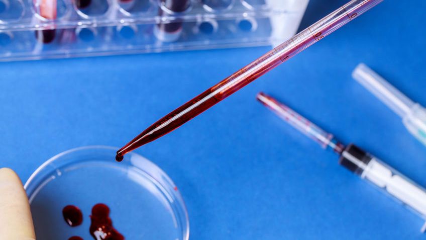 U osoby zdrowej nie występują przeciwciała anty-HCV. Wynik pozytywny oznacza, że organizm miał styczność z wirusem HCV. 