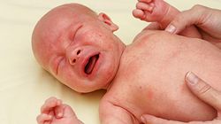 Wysypka u dziecka i niemowlaka - pokrzywka alergiczna, gorączka trzydniowa, różyczka, odra, ospa, trądzik, potówki