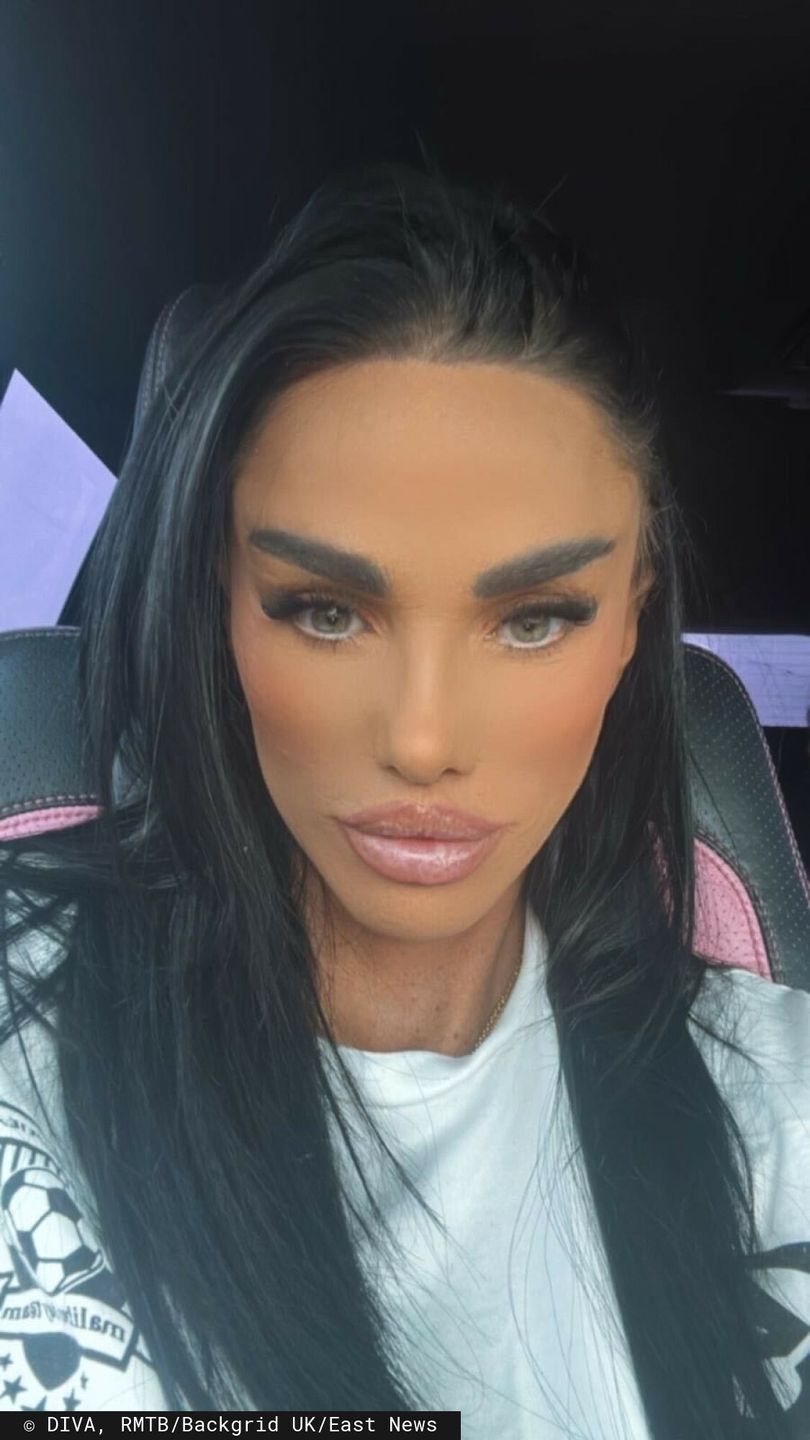 Katie Price pokazuje swój nowy nos