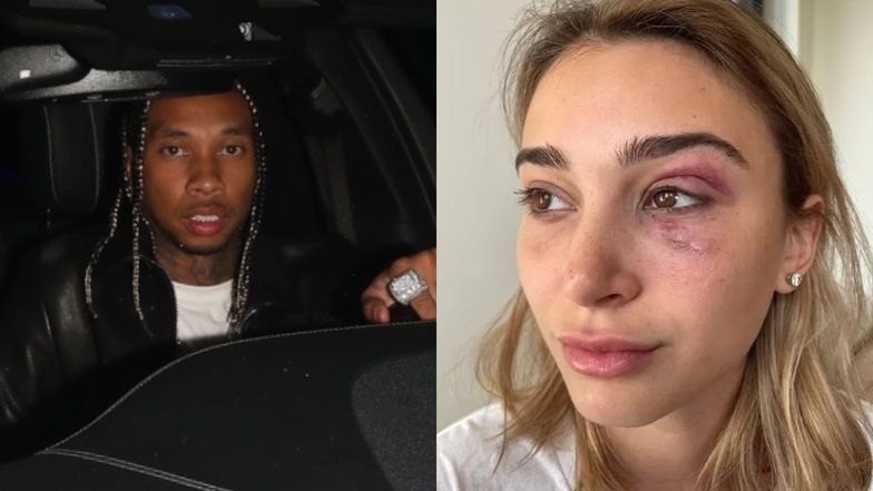 Tyga aresztowany za pobicie dziewczyny