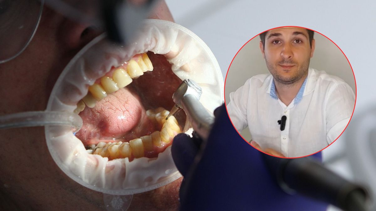 Przez niewyleczone zęby niejednokrotnie trzeba przerywać leczeni