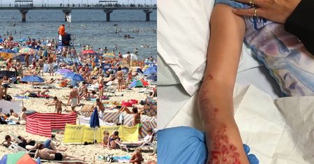 Dziecku spuchła ręka, bo namówiło mamę na tatuaż z henny. W składzie mógł być BARWNIK z FARBY do WŁOSÓW
