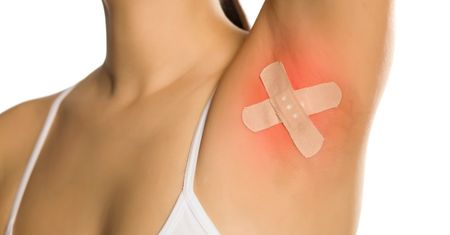 Wyprzenie skóry – przyczyny, objawy i leczenie