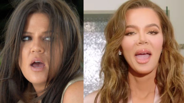 Twarz Khloe Kardashian ZNOWU się zmieniła! 