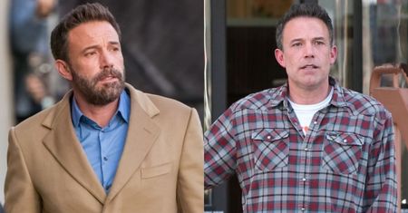 Ben Affleck majstrował przy twarzy? Ekspert zdradza, co mąż Jennifer Lopez miał sobie poprawić