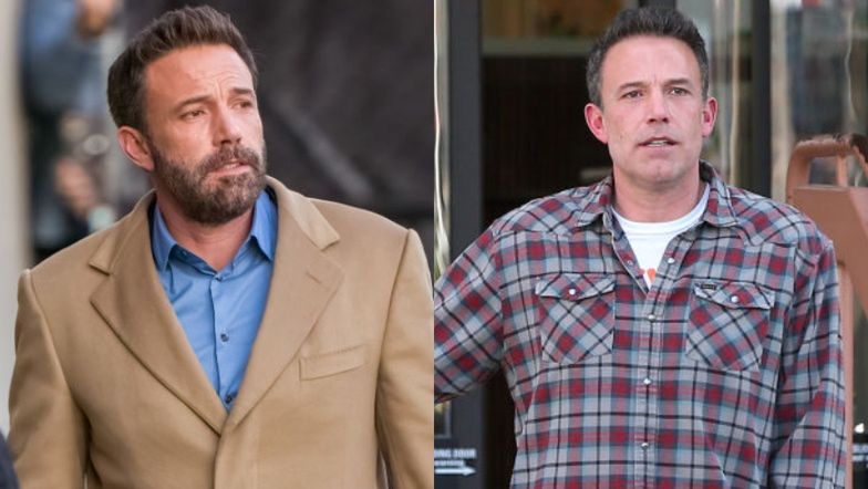 Ben Affleck majstrował przy twarzy? Ekspert zdradza, co mąż Jennifer Lopez miał sobie poprawić