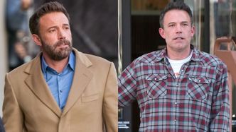 Ben Affleck majstrował przy twarzy? Ekspert zdradza, co mąż Jennifer Lopez miał sobie poprawić