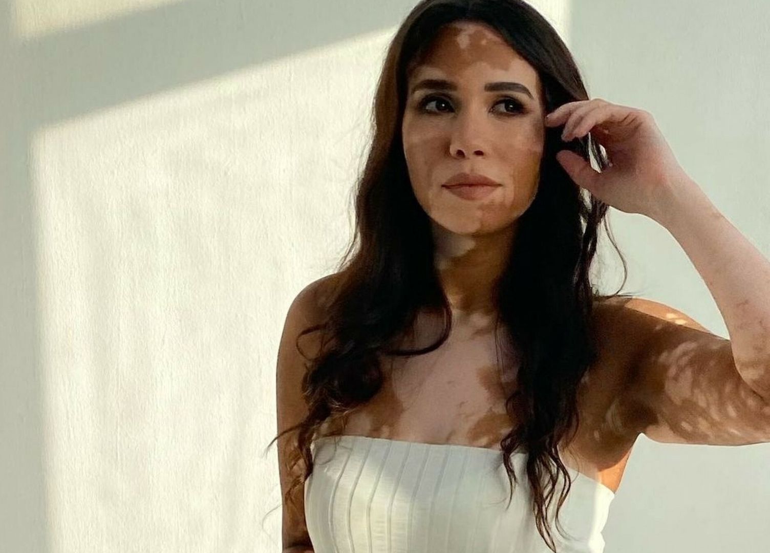 Wygl?da jak Meghan Markle z bielactwemReham only gathered the courage to accept her vitiligo six years ago. DUBAI, UNITED ARAB EMIRATES: MODEL turns the tables on trolls her called her a cow by being likened to Megan Markle with vitiligo. Vitiligo advocate Reham Soliman (34) from Cairo, Egypt was diagnosed with vitiligo at 14-years-old. Reham?s vitiligo started with a dot on her neck and spread to over 60% of her body. Growing up she was bullied for her skin condition and grew to resent it, feeling unconscious of her skin. Reham?s vitiligo held her back from many social occasions and tainted the happy moments of her life. She was bullied in school for her skin condition making her more conscious of her look. Reham only gathered the courage to accept her vitiligo six years ago, she reached a point where she was so disappointed, stressed and tired she gave up on caring what others thought of her. She decided to be herself in all respect and gained a newfound confidence. Reham has pleasantly surprised when she was approached by a modelling agency in 2020, which wanted to feature her in a skincare brand. She had not expected that at all, even though she has been told she looks like Meghan Markle with vitiligo. mediadrumimages.com/@rehamsolimansmediadrumimages.com/@rehamsolima