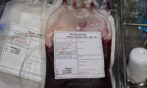 "Złota krew". Mają ją tylko 43 osoby na świecie