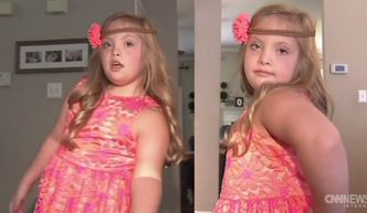 8-letnia modelka z zespołem Downa tańczy i śpiewa!