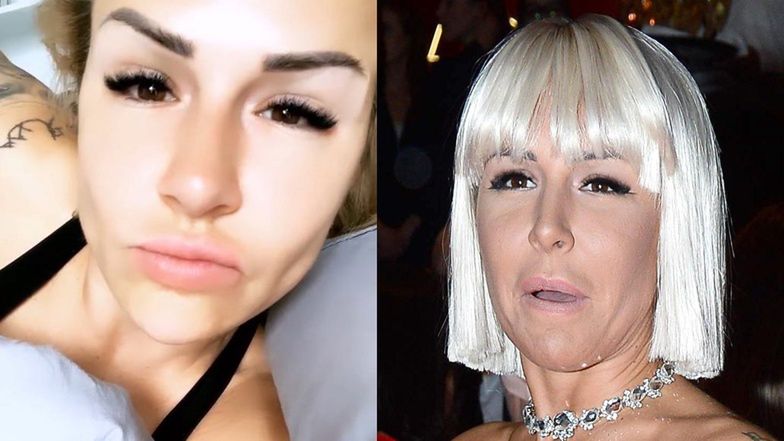 Blanka Lipińska planuje kolejne operacje