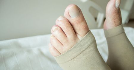 Ciche oznaki, które mogą świadczyć o zakrzepicy. Nigdy ich nie ignoruj