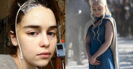 Emilia Clarke ma kompleksy po operacjach mózgu. "Nie chciałam patrzeć na swoją twarz"