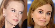 Kidman: "Przyznaję, że próbowałam botoksu" (FOTO)