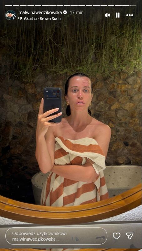 Malwina Wędzikowska miała wypadek na wakacjach 