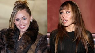 Miley Cyrus POZBYŁA SIĘ licówek. Jej fani od razu dostrzegli wyraźną zmianę: "Wygląda ZDROWIEJ" (ZDJĘCIA)