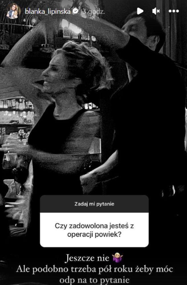 Blanka Lipińska o operacji powiek 
