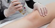 Depilacja laserowa – sposób na trwałe usunięcie owłosienia