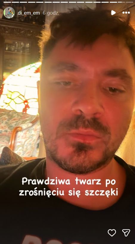 Daniel Martyniuk pokazał obrażenia