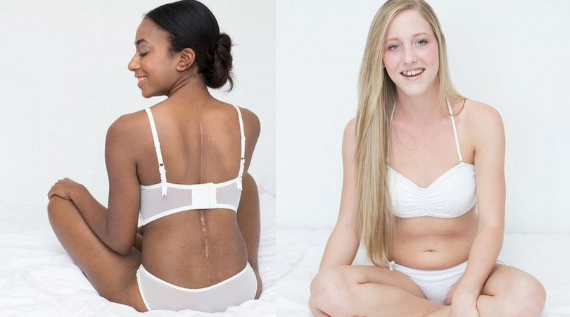 Fotografka Emily Lauren walczy z kompleksami kobiet