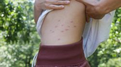 Widoczny objaw chorej trzustki. Alarmuje o zapaleniu lub nowotworze