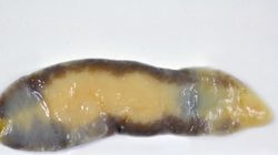 Fasciolopsis buski- cykl rozwojowy, objawy i leczenie fasciolopsozy