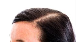 Zincuprin - charakterystyka, działanie, opinie, cena, przeciwwskazania