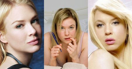 Te gwiazdy cierpią na "syndrom Zellweger"... (ZDJĘCIA)