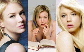 Te gwiazdy cierpią na "syndrom Zellweger"... (ZDJĘCIA)