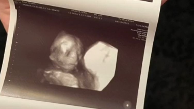 Poszła na badanie USG 3D.