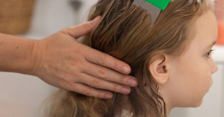 Nałóż na włosy. Wszy uciekną w popłochu