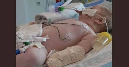 Mama myślała, że to tylko katar. Dziecko trzeba było wprowadzić w śpiączkę