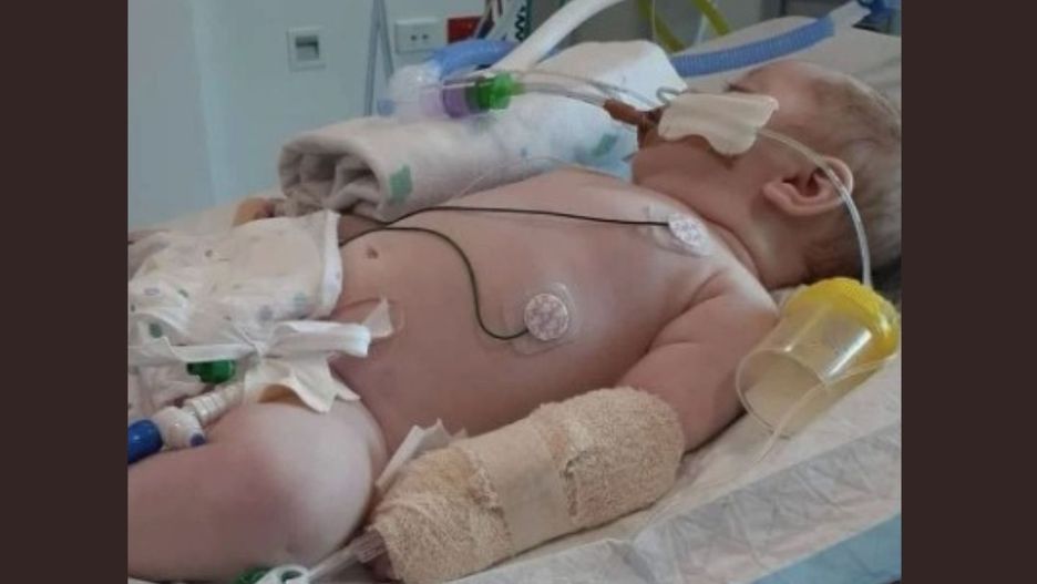 Zaczęło się od przeziębienia. Niemowlę trzeba było wprowadzić w śpiączkę