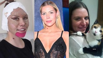 Julia von Stein zafundowała sobie lifting twarzy. Pamiętacie, jak KIEDYŚ wyglądała?