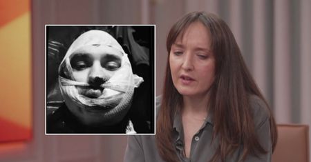 "Zobaczył w lustrze potwora". Wstrząsające relacje rannych Ukraińców