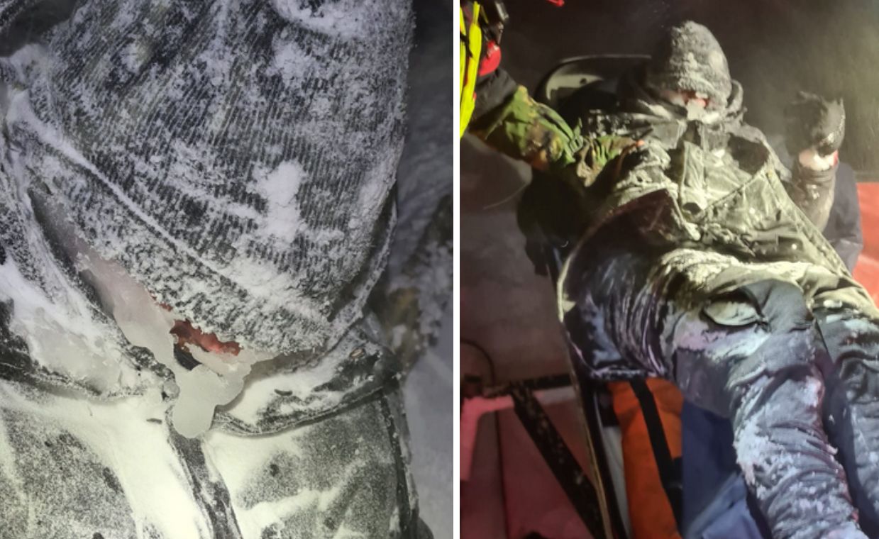 Tak wyglądał, gdy go znaleźli. Szokujące zdjęcia