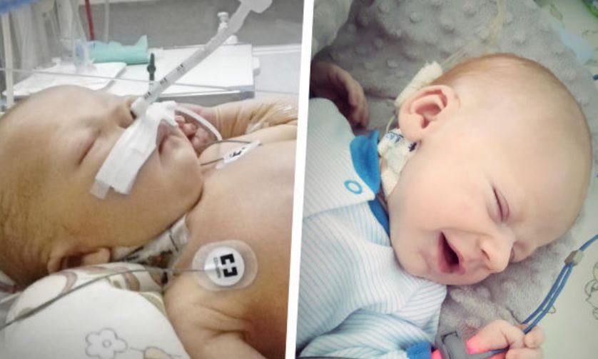 Pierwsze dwa miesiące życia chłopiec spędził w szpitalu