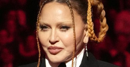 Madonna powraca z wyprasowaną twarzą i zaczepia krytyków: "Jestem piękna, zeszła mi OPUCHLIZNA PO OPERACJI" (FOTO)