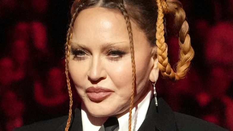 Madonna powraca z wyprasowaną twarzą i zaczepia krytyków: "Jestem piękna, zeszła mi OPUCHLIZNA PO OPERACJI" (FOTO)