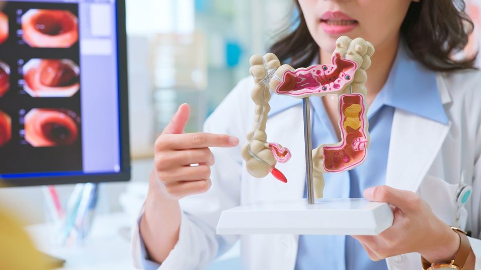 medical consultation after colonoscopy