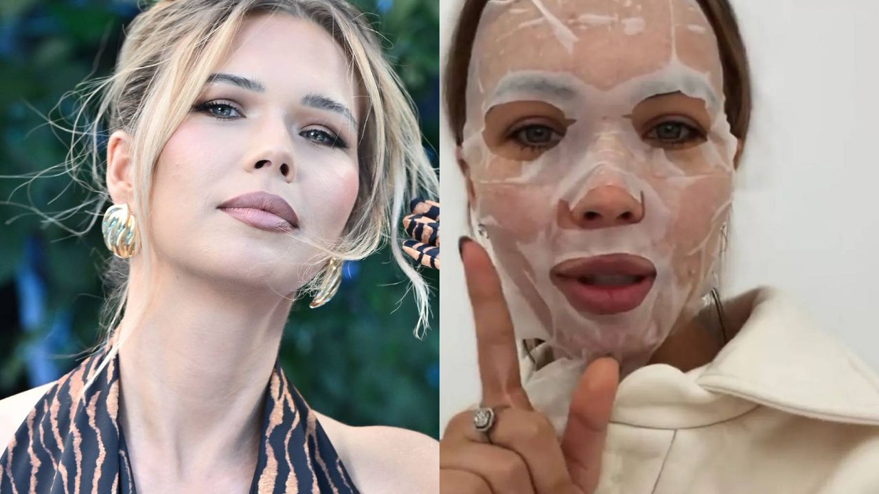 Sandra Kubicka zrelacjonowała GRUPOWY wypad na botoks. Ekspertka z niepokojem: "Wzmacnia presję wyglądu"