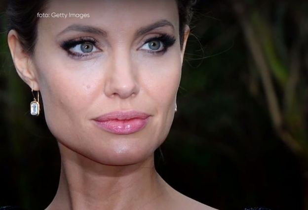 Jolie Cierpi Na Porażenie Nerwu Twarzowego Ma Niedowład Twarzy I Nie Może Do Końca Zamknąć 4333