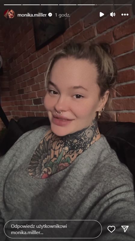 Monika Miller po zabiegu dentystycznym