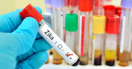 ZIKA groźna tylko dla kobiet w pierwszym trymestrze ciąży?