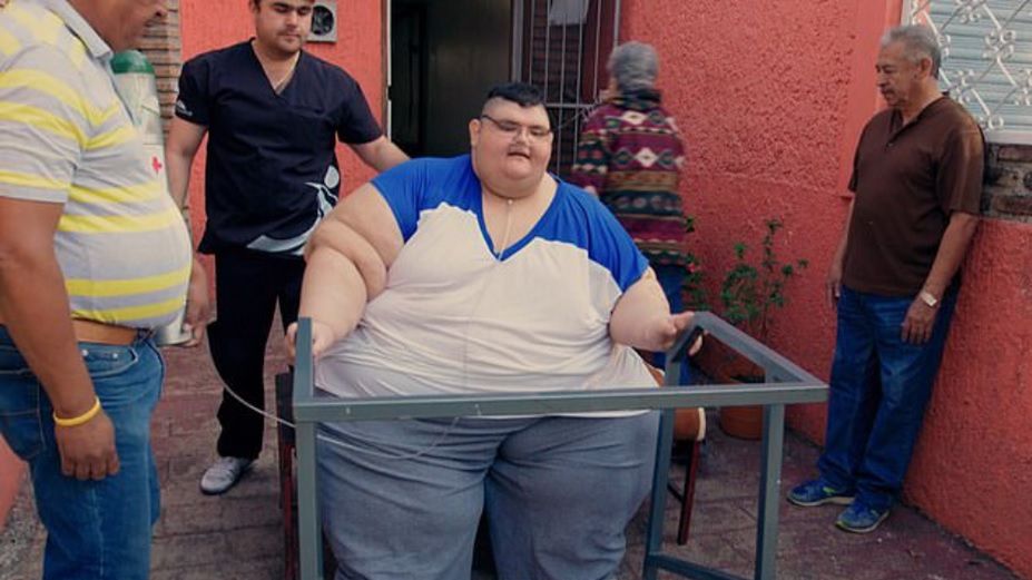 Juan Pedro Franco jest już po dwóch operacjach zmniejszenia żołądka