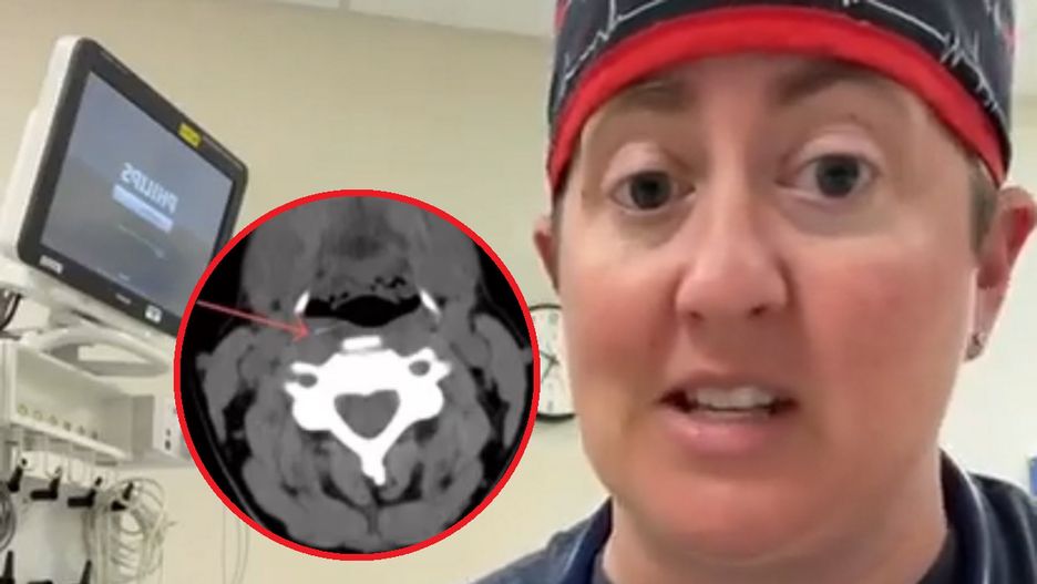 Lekarze ostrzegają przed narzędziem do czyszczenia. Mogło doprowadzić do śmierci 4-latka