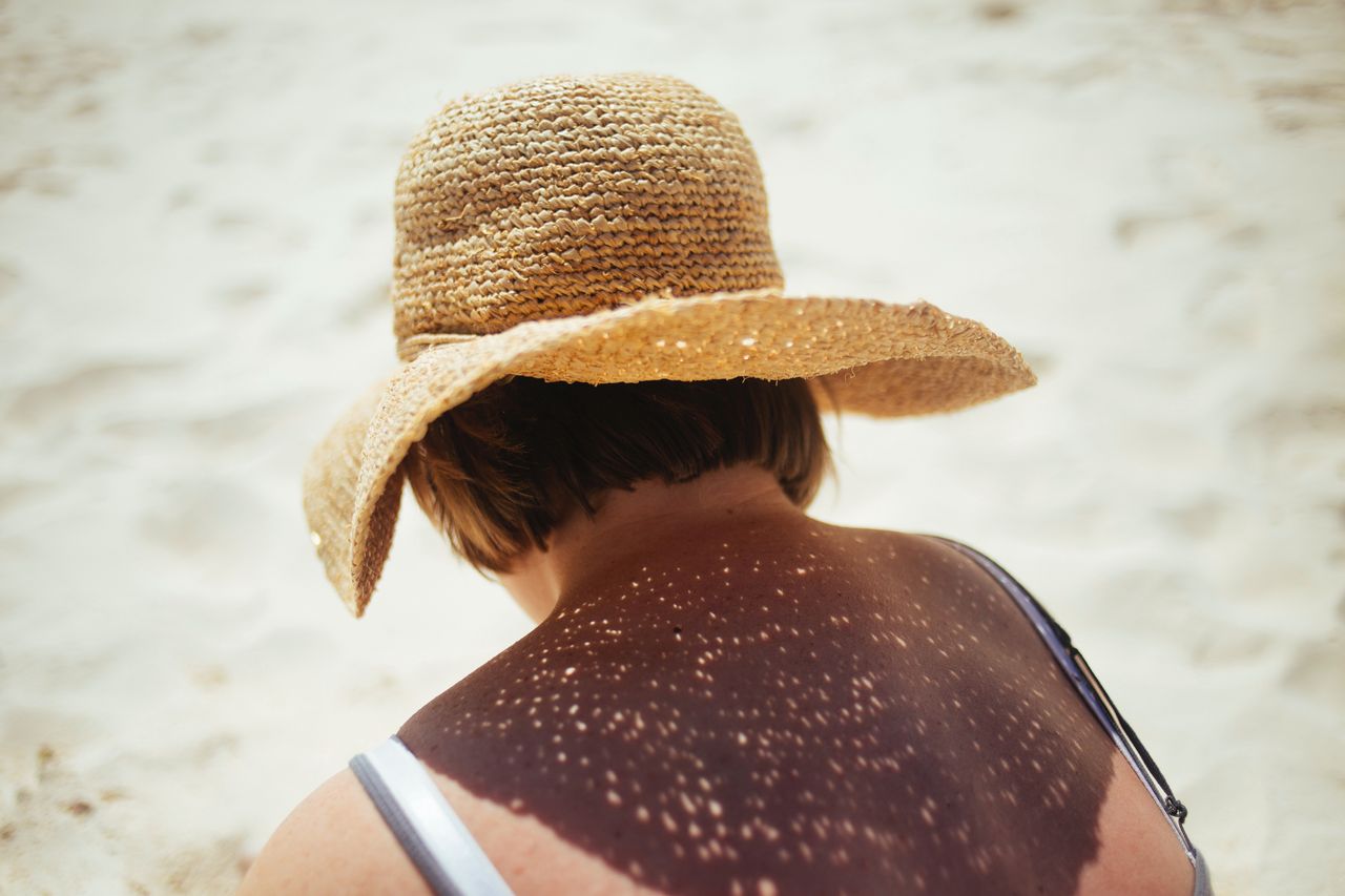 Plażowy niezbędnik pielęgnacyjny. Jak dbać o skórę podczas wakacji?