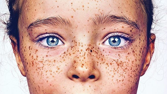 Piegi to jego ulubiony akcent ludzkiej urody. Fotografuje je non stop! 1