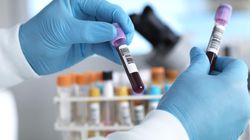 Długość życia zapisana we krwi. Naukowcy opracowali "zegar wieku"