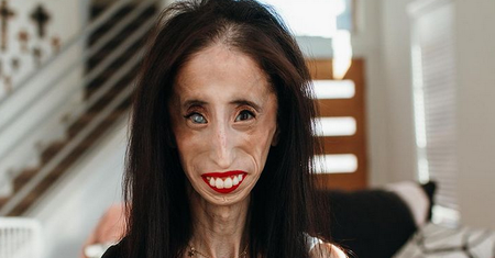 "Najbrzydsza kobieta świata". Kim jest Lizzie Velásquez?